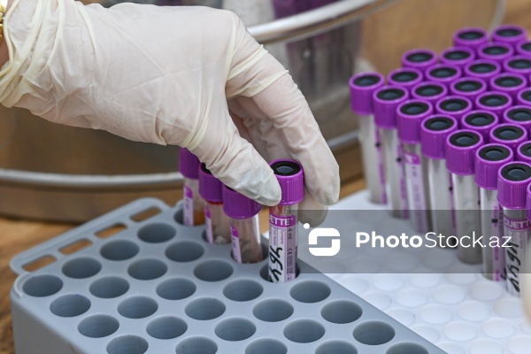 1 dekabr - Ümumdünya QİÇS-lə Mübarizə Günü