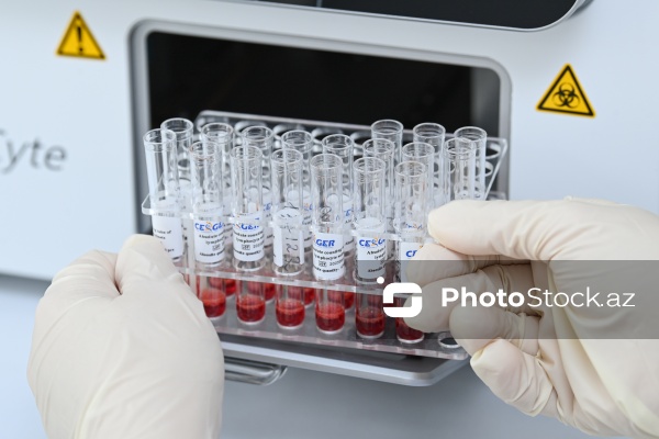 1 dekabr - Ümumdünya QİÇS-lə Mübarizə Günü