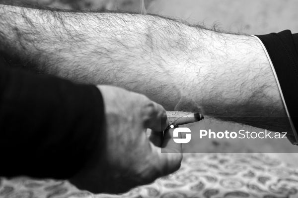 Qədim türkəçarə üsullarından biri olan çıldaq