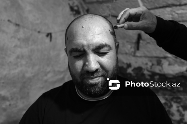 Qədim türkəçarə üsullarından biri olan çıldaq