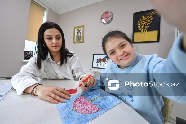 21 mart – Beynəlxalq Daun Sindromu Günü