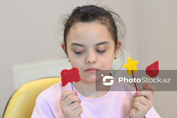 21 mart – Beynəlxalq Daun Sindromu Günü