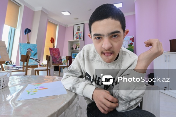 21 mart – Beynəlxalq Daun Sindromu Günü