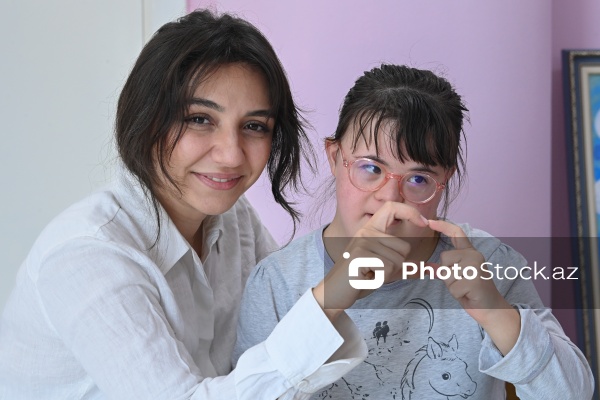 21 mart – Beynəlxalq Daun Sindromu Günü