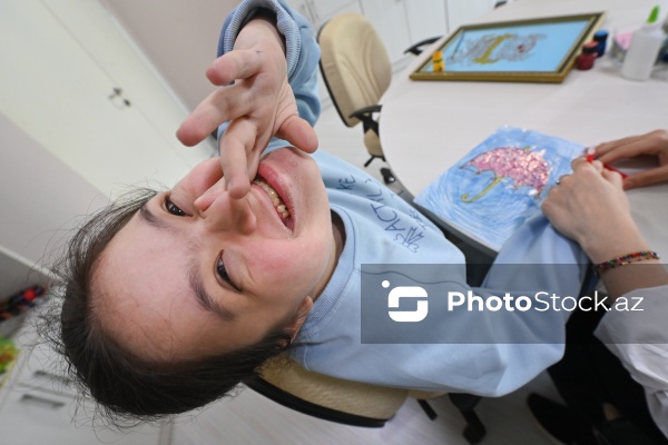 21 mart – Beynəlxalq Daun Sindromu Günü