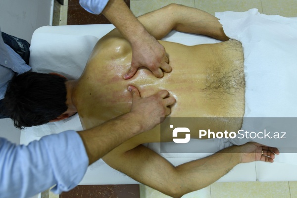 Ənənəvi müalicə üsulu olan hicama prosesi