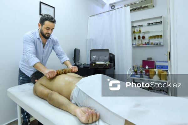 Ənənəvi müalicə üsulu olan hicama prosesi