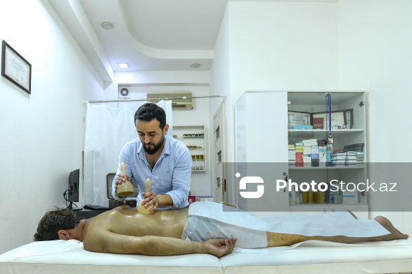 Ənənəvi müalicə üsulu olan hicama prosesi