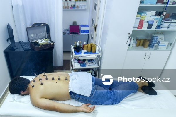 Ənənəvi müalicə üsulu olan hicama prosesi