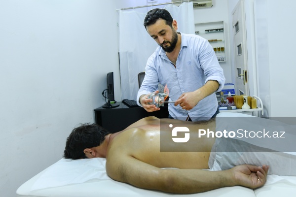 Ənənəvi müalicə üsulu olan hicama prosesi