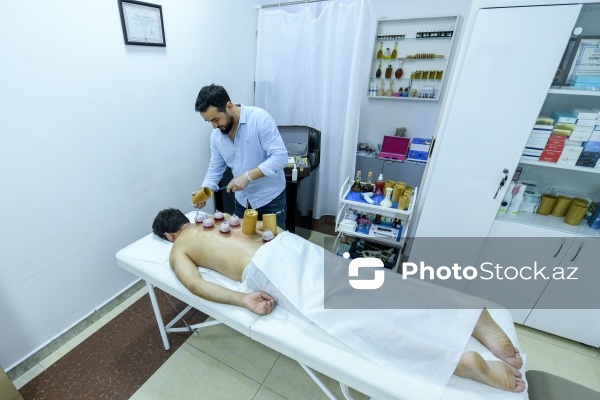 Ənənəvi müalicə üsulu olan hicama prosesi