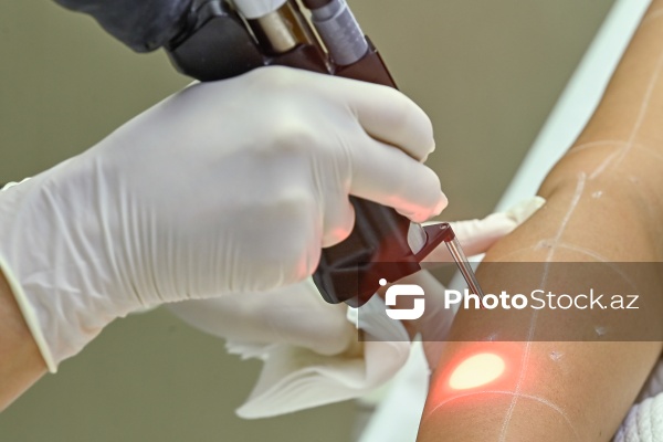 Xanımların xüsusi əhəmiyyət verdiyi gözəllik prosedurları