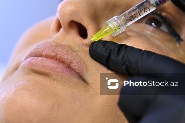 Xanımların xüsusi əhəmiyyət verdiyi gözəllik prosedurları