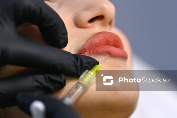 Xanımların xüsusi əhəmiyyət verdiyi gözəllik prosedurları