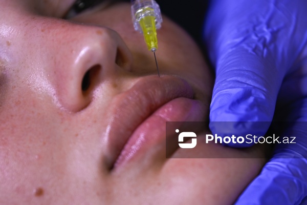 Xanımların xüsusi əhəmiyyət verdiyi gözəllik prosedurları