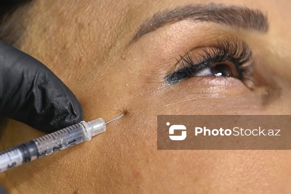 Xanımların xüsusi əhəmiyyət verdiyi gözəllik prosedurları