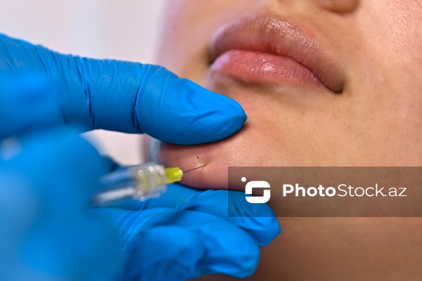 Xanımların xüsusi əhəmiyyət verdiyi gözəllik prosedurları