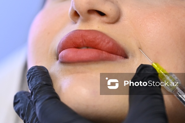 Xanımların xüsusi əhəmiyyət verdiyi gözəllik prosedurları