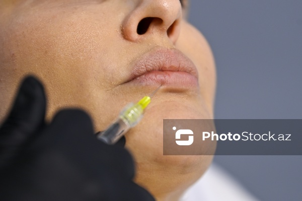 Xanımların xüsusi əhəmiyyət verdiyi gözəllik prosedurları