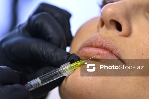 Xanımların xüsusi əhəmiyyət verdiyi gözəllik prosedurları