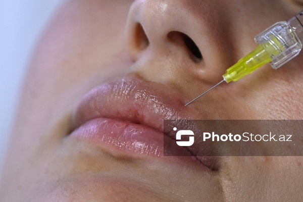 Xanımların xüsusi əhəmiyyət verdiyi gözəllik prosedurları