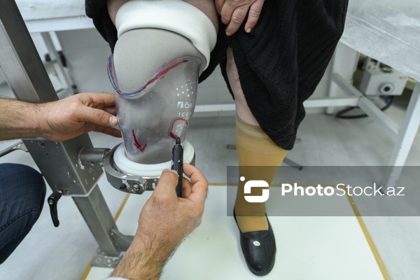 Protez-Ortopedik Bərpa Mərkəzi