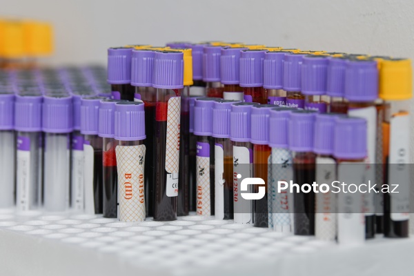 "Global Media Group"da qanvermə aksiyası keçirilib