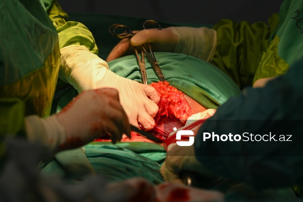 Qeysəriyyə əməliyyatı