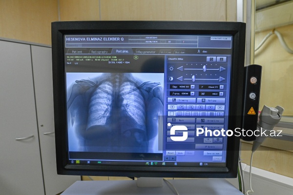 “Yeni Klinika”da icra olunan Rentgen müayinəsi