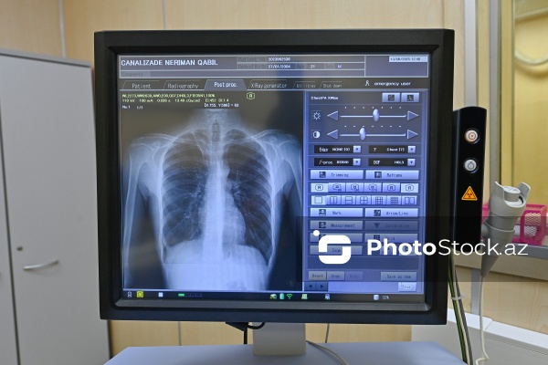“Yeni Klinika”da icra olunan Rentgen müayinəsi