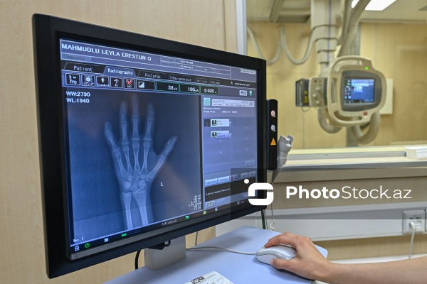 “Yeni Klinika”da icra olunan Rentgen müayinəsi