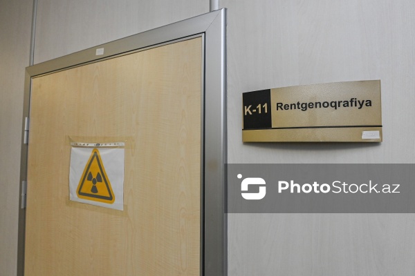 “Yeni Klinika”da icra olunan Rentgen müayinəsi