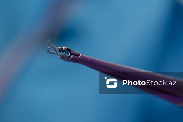 Respublika Neyrocərrahiyyə Xəstəxanasında icra edilən beyin əməliyyatı