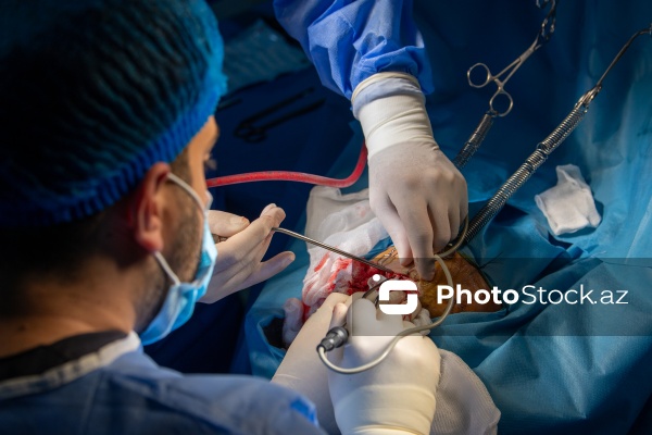 Respublika Neyrocərrahiyyə Xəstəxanasında icra edilən beyin əməliyyatı