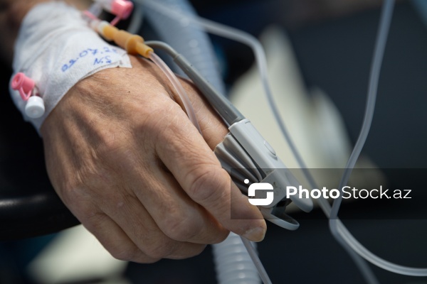 Respublika Neyrocərrahiyyə Xəstəxanasında icra edilən beyin əməliyyatı