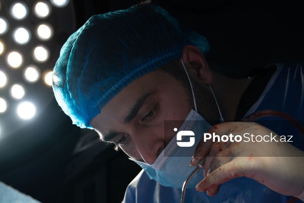 Respublika Neyrocərrahiyyə Xəstəxanasında icra edilən beyin əməliyyatı