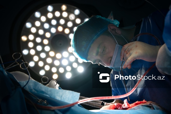Respublika Neyrocərrahiyyə Xəstəxanasında icra edilən beyin əməliyyatı