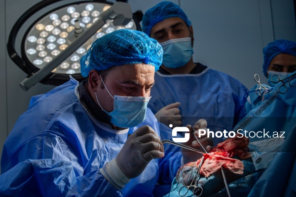 Respublika Neyrocərrahiyyə Xəstəxanasında icra edilən beyin əməliyyatı