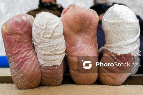 Xocalı faciəsi zamanı doqquz gün meşədə qalan Salman Abbasov və Bəsti Abbasova