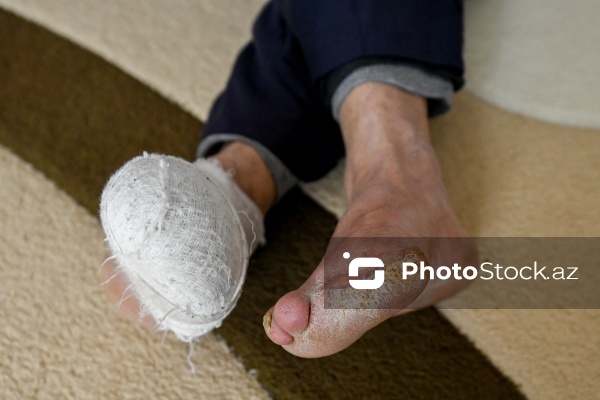 Xocalı faciəsi zamanı doqquz gün meşədə qalan Salman Abbasov və Bəsti Abbasova