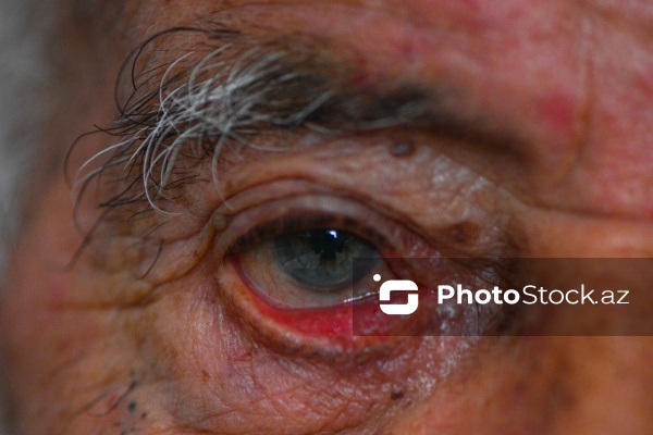 Xocalı faciəsi zamanı doqquz gün meşədə qalan Salman Abbasov və Bəsti Abbasova