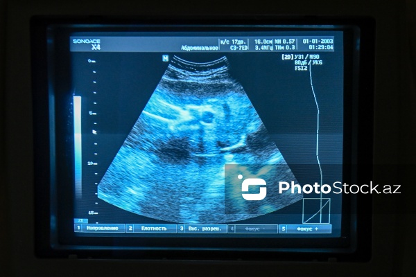 Səhiyyə Nazirliyinin Bakı Şəhər Herontoloji Mərkəzi