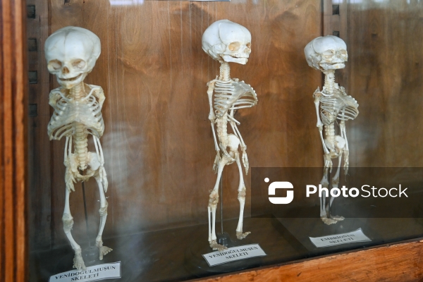 Tibb universitetinin Terapevtik korpusunda anatomiya muzeyi