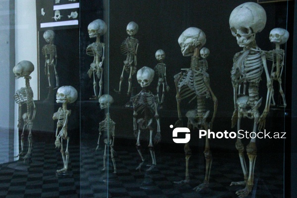 Bir əsrə yaxın yaşı olan Azərbaycan Tibb Universiteti