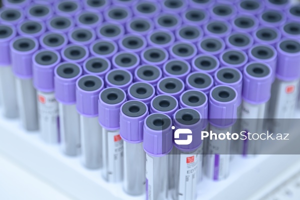 14 Noyabr - Ümumdünya Diabet Günü