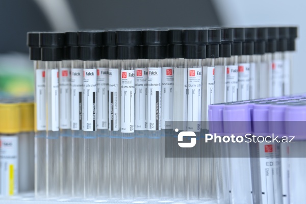 14 Noyabr - Ümumdünya Diabet Günü