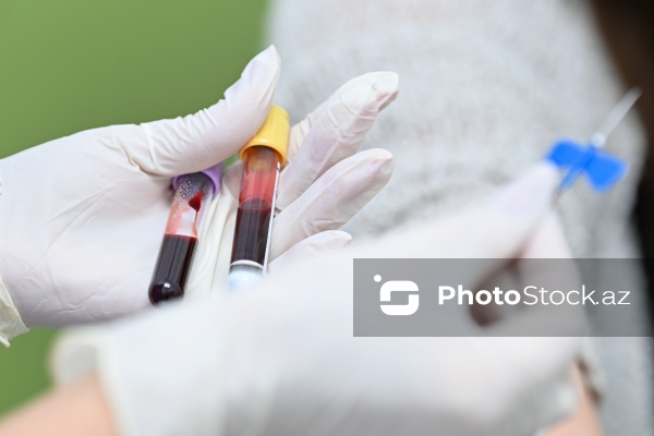 14 Noyabr - Ümumdünya Diabet Günü