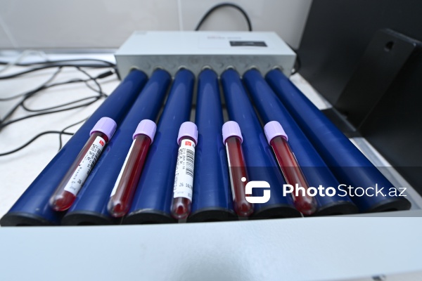 14 Noyabr - Ümumdünya Diabet Günü