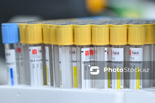 14 Noyabr - Ümumdünya Diabet Günü