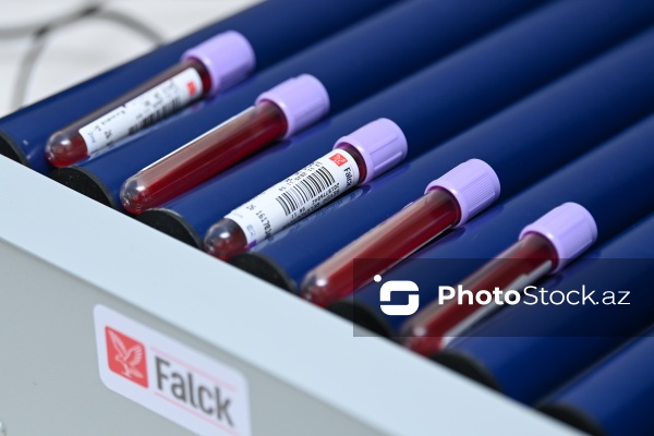 14 Noyabr - Ümumdünya Diabet Günü